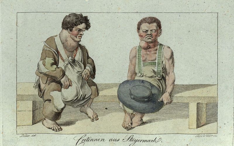 Illustration représentant deux personnes atteintes de crétinisme. Les deux individus sont de petite taille et ont chacun un goitre visible au niveau du cou.